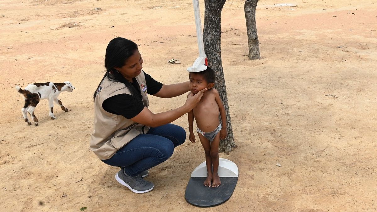 Fotky z Kolumbie, kde podvýživa zabíjí malé děti